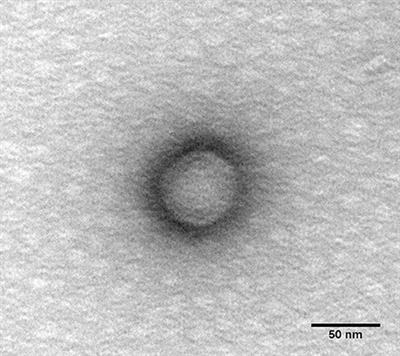 Chestnut Honey and Bacteriophage Application to Control Pseudomonas aeruginosa and Escherichia coli Biofilms: Evaluation in an ex vivo Wound Model